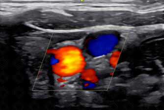 Texto alternativo para a imagem