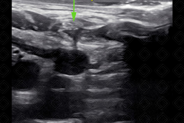 Texto alternativo para a imagem