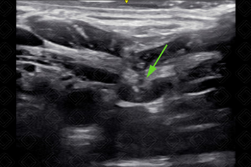 Texto alternativo para a imagem