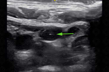 Texto alternativo para a imagem