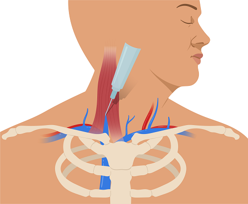 Texto alternativo para a imagem