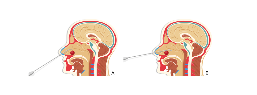 Texto alternativo para a imagem