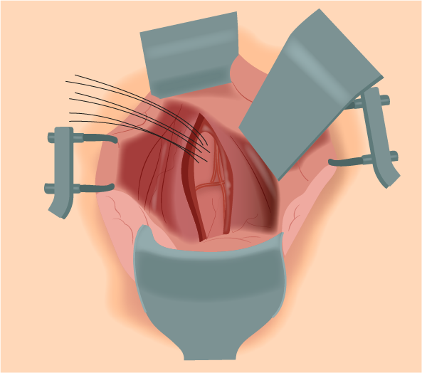 Texto alternativo para a imagem