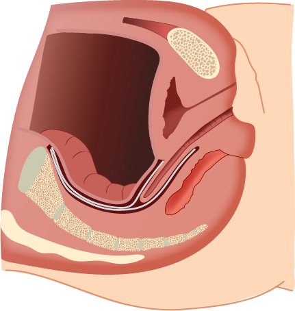 Texto alternativo para a imagem