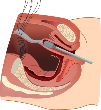 Texto alternativo para a imagem