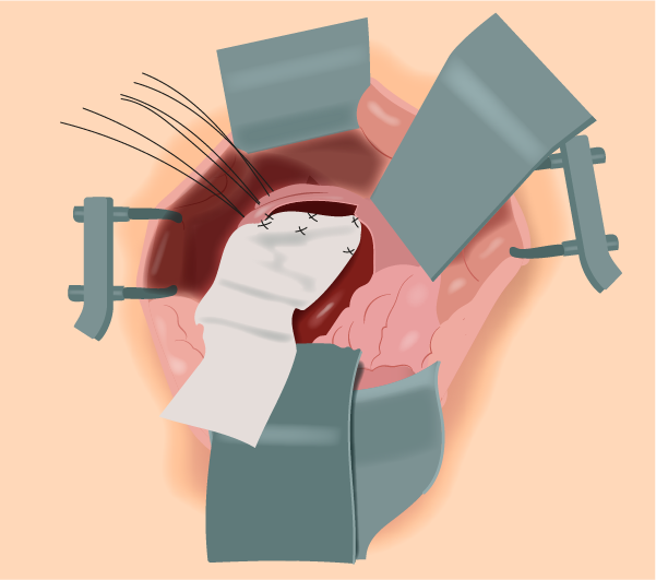 Texto alternativo para a imagem