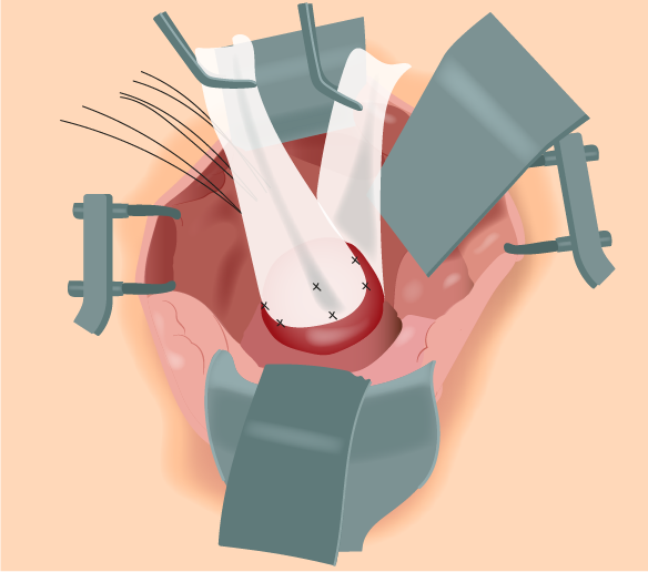 Texto alternativo para a imagem