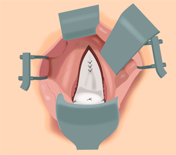 Texto alternativo para a imagem