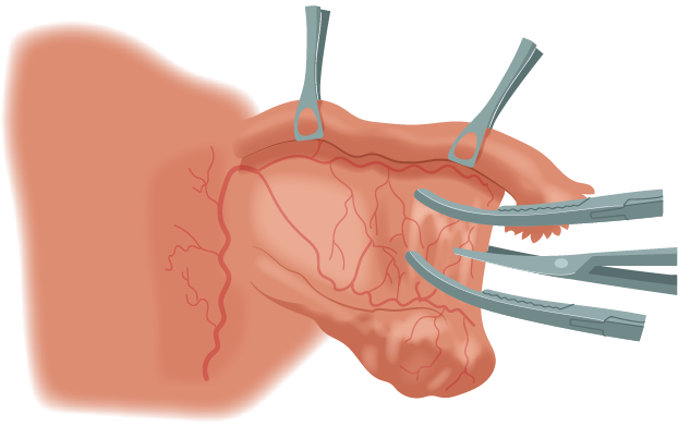 Texto alternativo para a imagem
