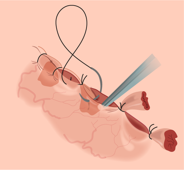 Texto alternativo para a imagem