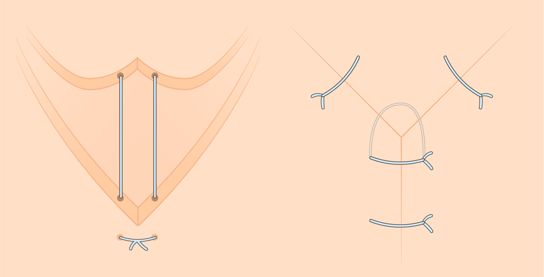 Texto alternativo para a imagem