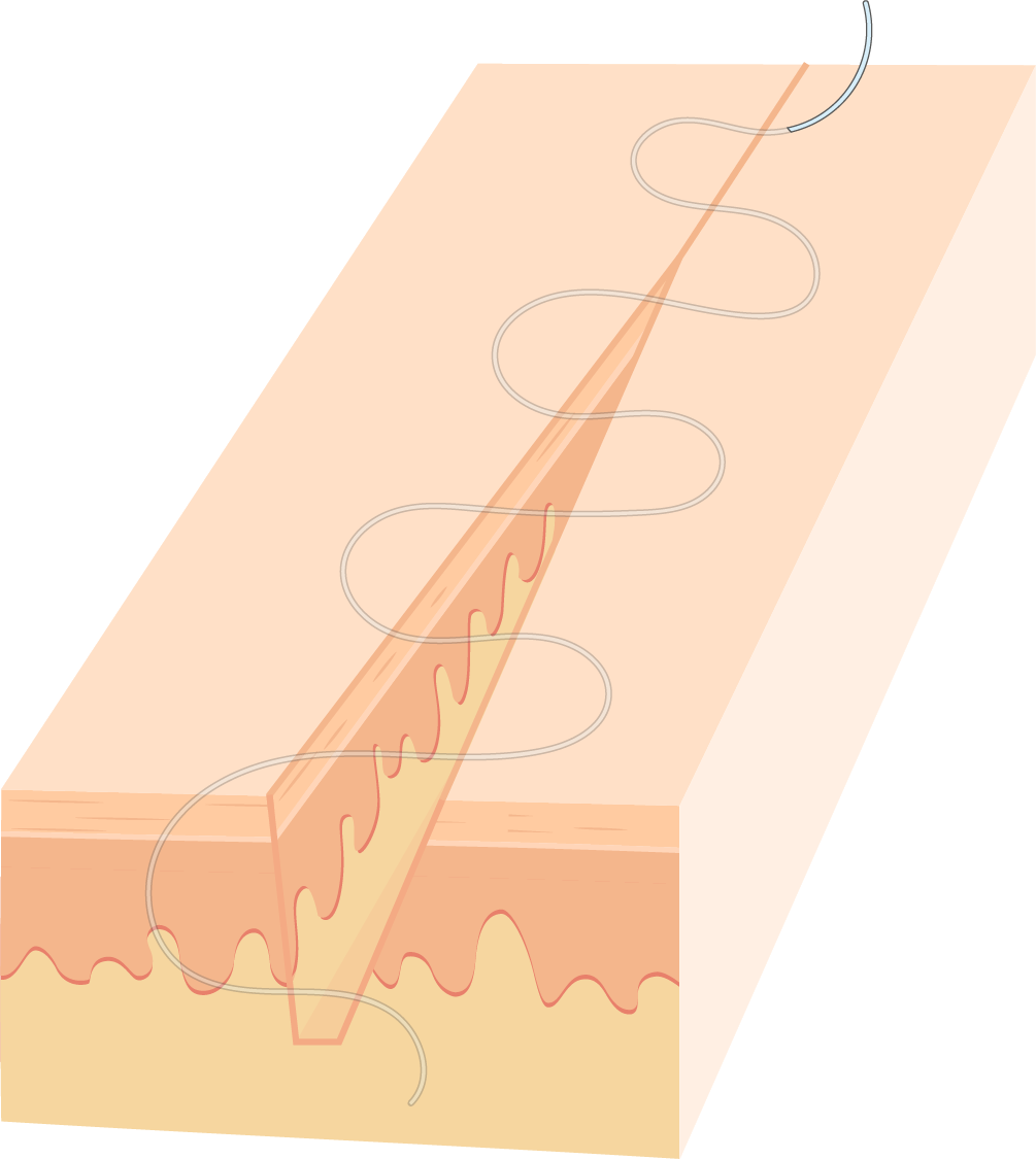 Texto alternativo para a imagem