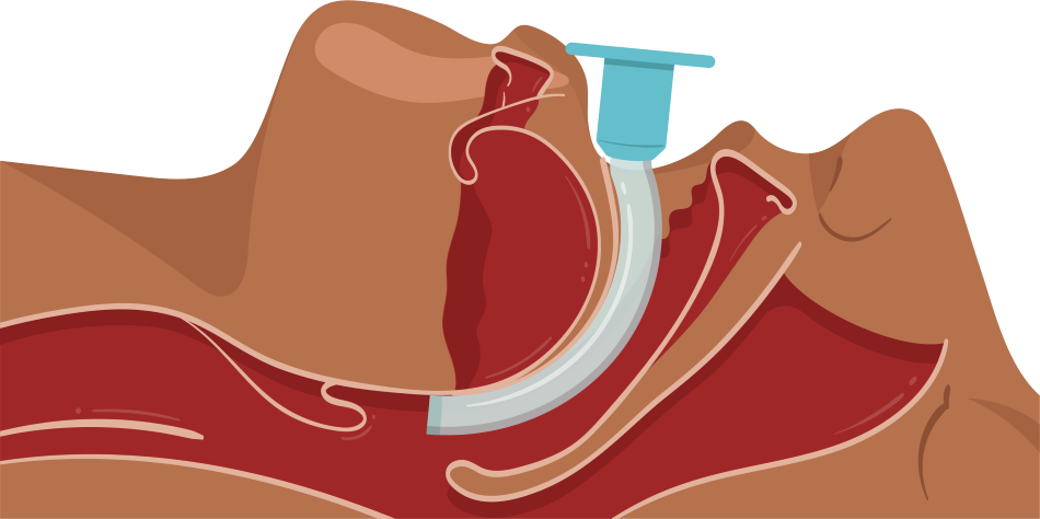 Texto alternativo para a imagem