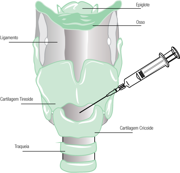 Texto alternativo para a imagem