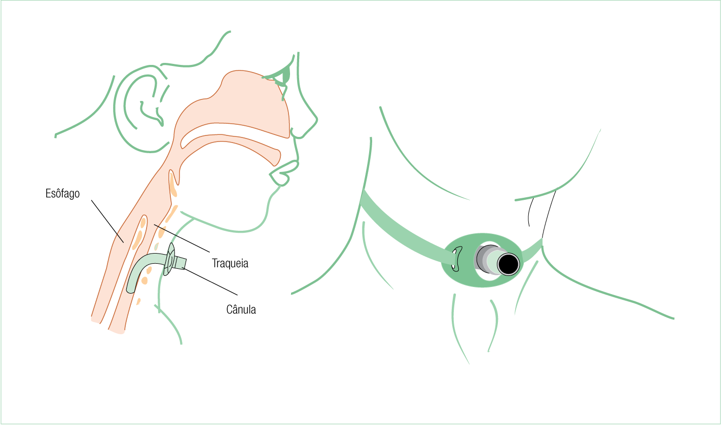 Texto alternativo para a imagem