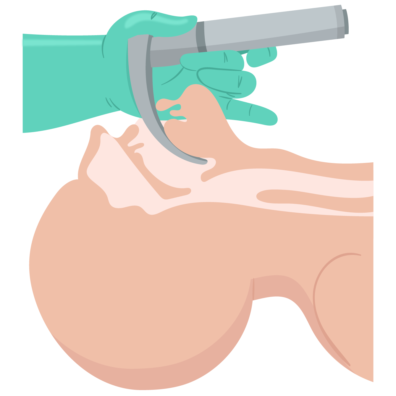 Texto alternativo para a imagem