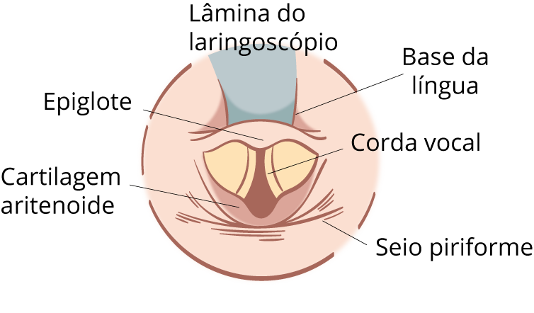 Texto alternativo para a imagem