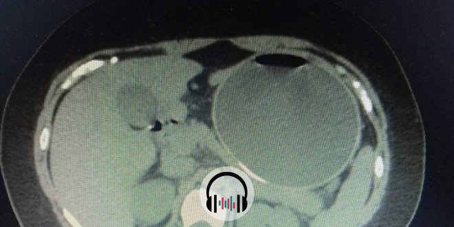 tc-abdominal-capa.jpg