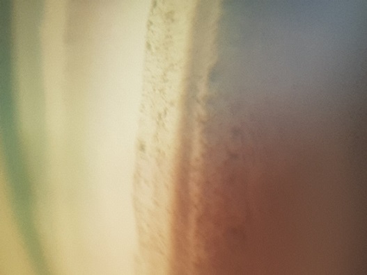 Gonioscopia