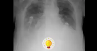 radiografia torax