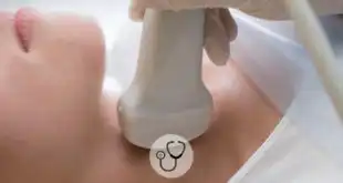 hipertireoidismo