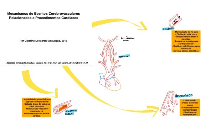 Ilustração dos mecanismos relacionados aos eventos cerebrovasculares decorrentes de procedimentos cardíacos