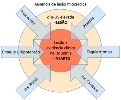 infarto definição
