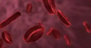 hipercalcemia
