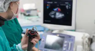 ecocardiograma