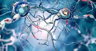 epilepsia