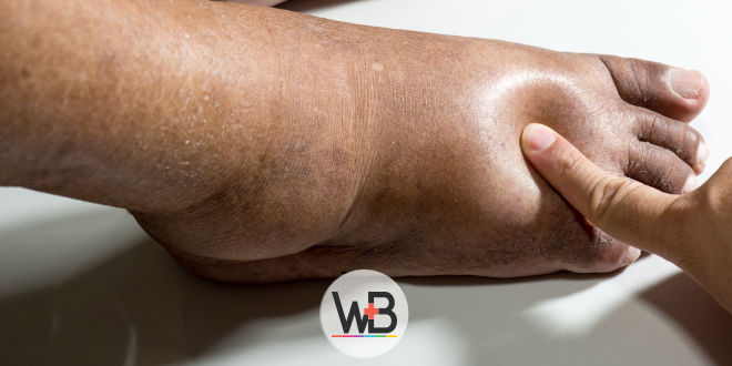 Vascular periférica médica definição