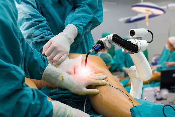 video laparoscopia de prostata