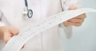 médico segurando resultado de eletrocardiograma com taquicardia supraventricular
