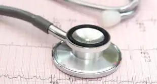 eletrocardiograma com um estetoscopio em cima mostrando extrassístoles ventriculares