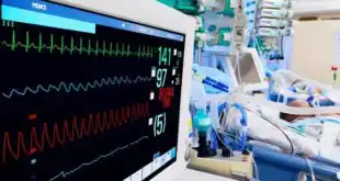 unidade de terapia intensiva pediátrica, com monitor ECG em foco, e criança com coronavírus