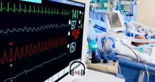 monitor de terapia intensiva com paciente covid-19