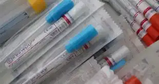 Ministério da Saúde publica portaria tornando a notificação dos testes para Covid-19 obrigatória
