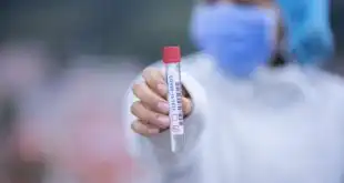 Teste na saliva seria uma boa opção para diagnóstico de Covid-19?