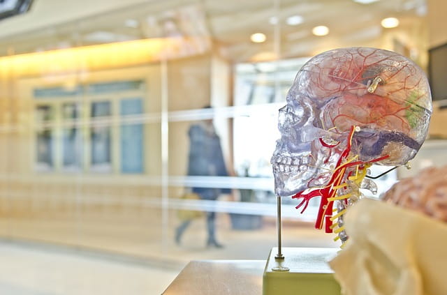 Representação de um cérebro humano que pode sofrer trombose venosa cerebral