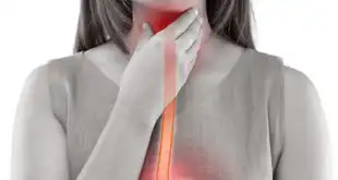 Representação gráfica de mulher sofrendo com esofagite eosinofílica