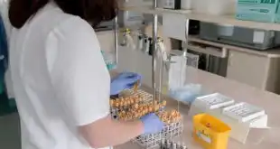 Representação de laboratório de análise de testes RT-PCR para Covid-19