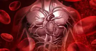 Paciente com fibrilação atrial (FA) paroxística podem encontrar na ablação e isolamento das veias pulmonares uma opção de tratamento.