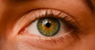 Paciente com glaucoma de ângulo fechado, o que fazer?