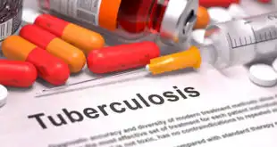 Novo teste de detecção da tuberculose