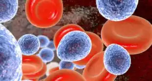 imagem digital de infecção sanguínea por Candida auris