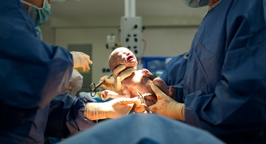 Bebê nascido de gestação com obesidade materna