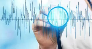 Infarto agudo do miocárdio tipo 2: qual a prevalência e especificidades?
