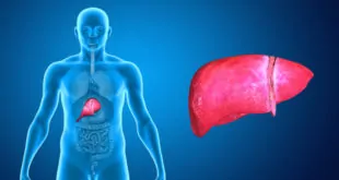 Hepatite C é uma infecção que ataca o fígado