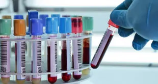 hemograma e divergências entre análises automatizadas e à microscópia óptica
