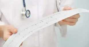 médico segurando eletrocardiograma de paciente em uso de finerenone